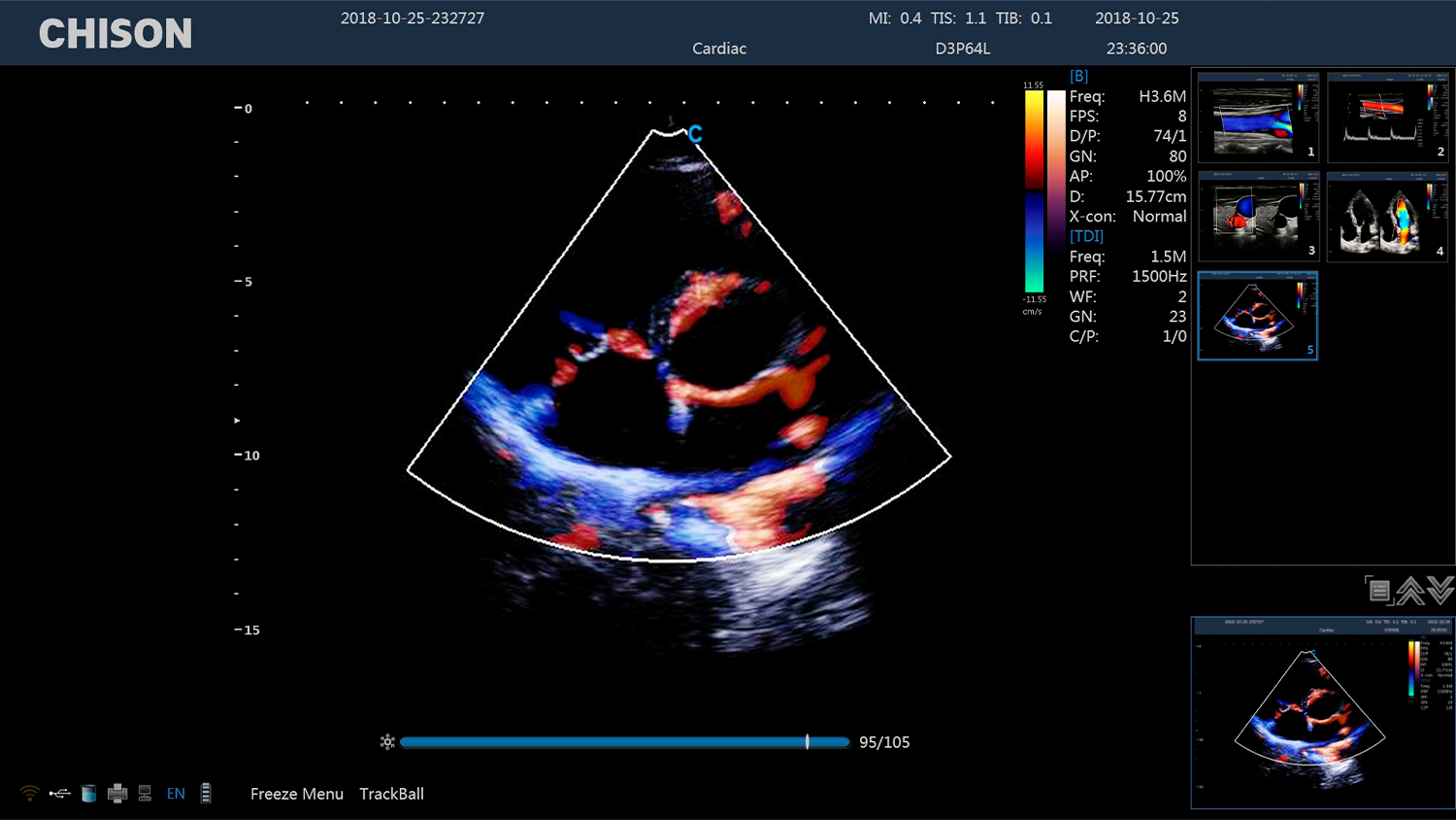 CBit 4 Cardiac TDI
